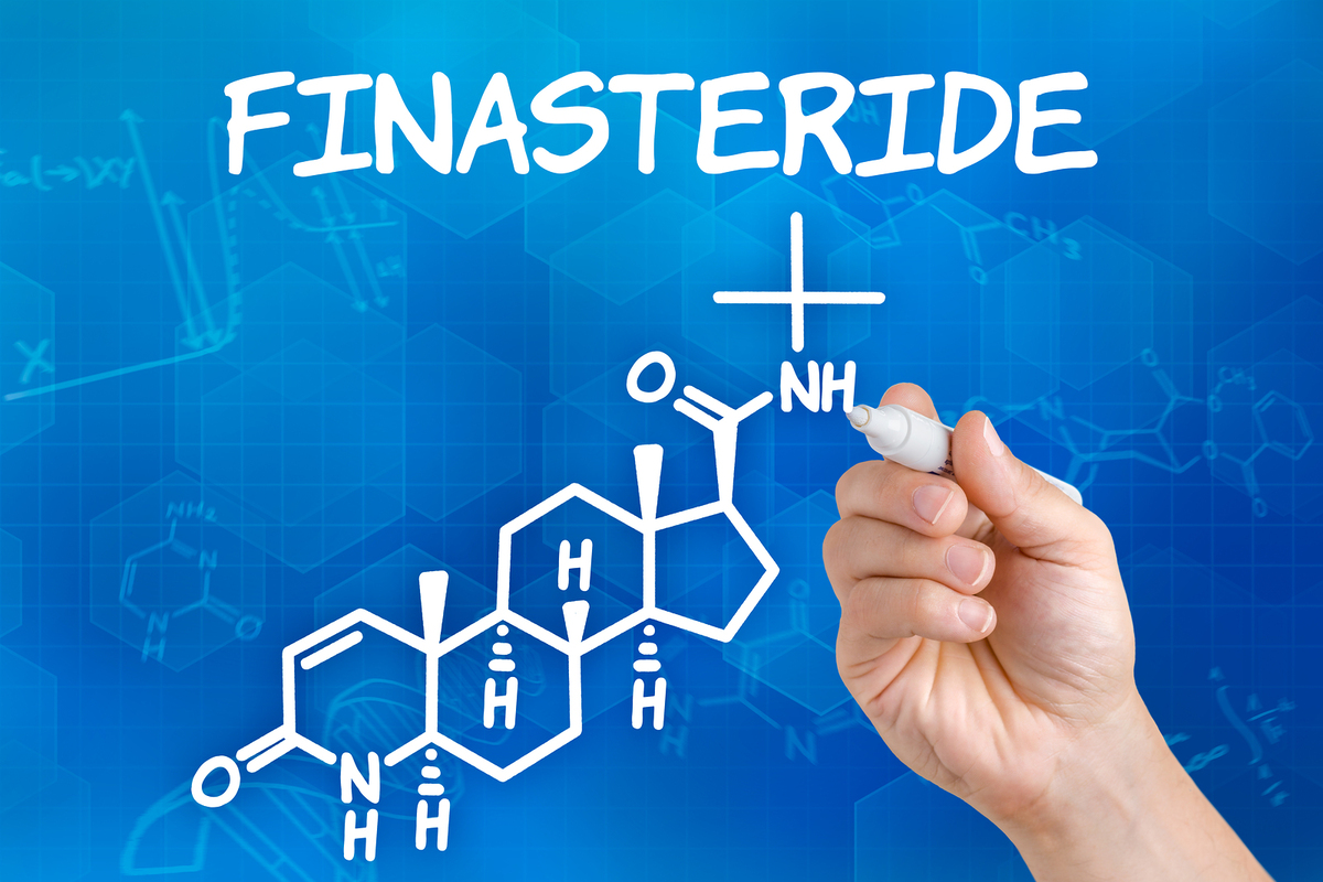 Finasteride.
